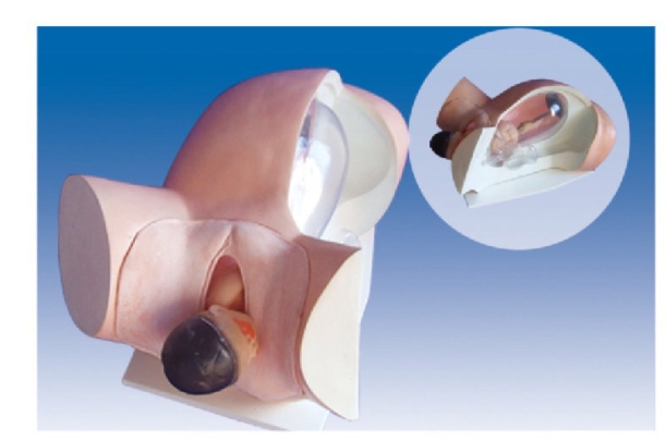 胎兒分娩機轉(zhuǎn)示教模型