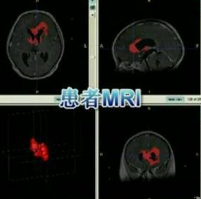 MRI設(shè)備結(jié)構(gòu)虛擬仿真教學系統(tǒng)