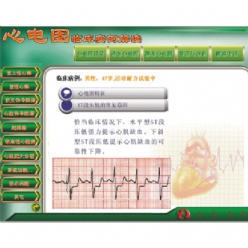 新版心電圖教學軟件心電圖臨床實例解讀